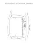 SENSORS FOR DETECTING SUBSTANCES INDICATIVE OF STROKE, ISCHEMIA, INFECTION     OR INFLAMMATION diagram and image