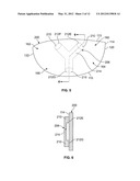 GOLF CLUB HEAD OR OTHER BALL STRIKING DEVICE HAVING STIFFENED FACE PORTION diagram and image