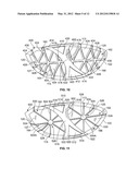 GOLF CLUB HEAD OR OTHER BALL STRIKING DEVICE HAVING STIFFENED FACE PORTION diagram and image