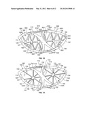 GOLF CLUB HEAD OR OTHER BALL STRIKING DEVICE HAVING STIFFENED FACE PORTION diagram and image