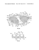 GOLF CLUB HEAD OR OTHER BALL STRIKING DEVICE HAVING STIFFENED FACE PORTION diagram and image