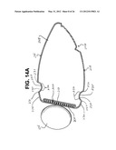 Golf Club Heads Or Other Ball Striking Devices Having Distributed Impact     Response diagram and image