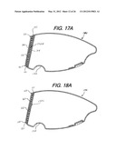 Golf Club Heads Or Other Ball Striking Devices Having Distributed Impact     Response diagram and image