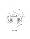 Golf Club Heads Or Other Ball Striking Devices Having Distributed Impact     Response diagram and image