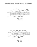 Methods and Apparatus for Measuring Analytes Using Large Scale FET Arrays diagram and image