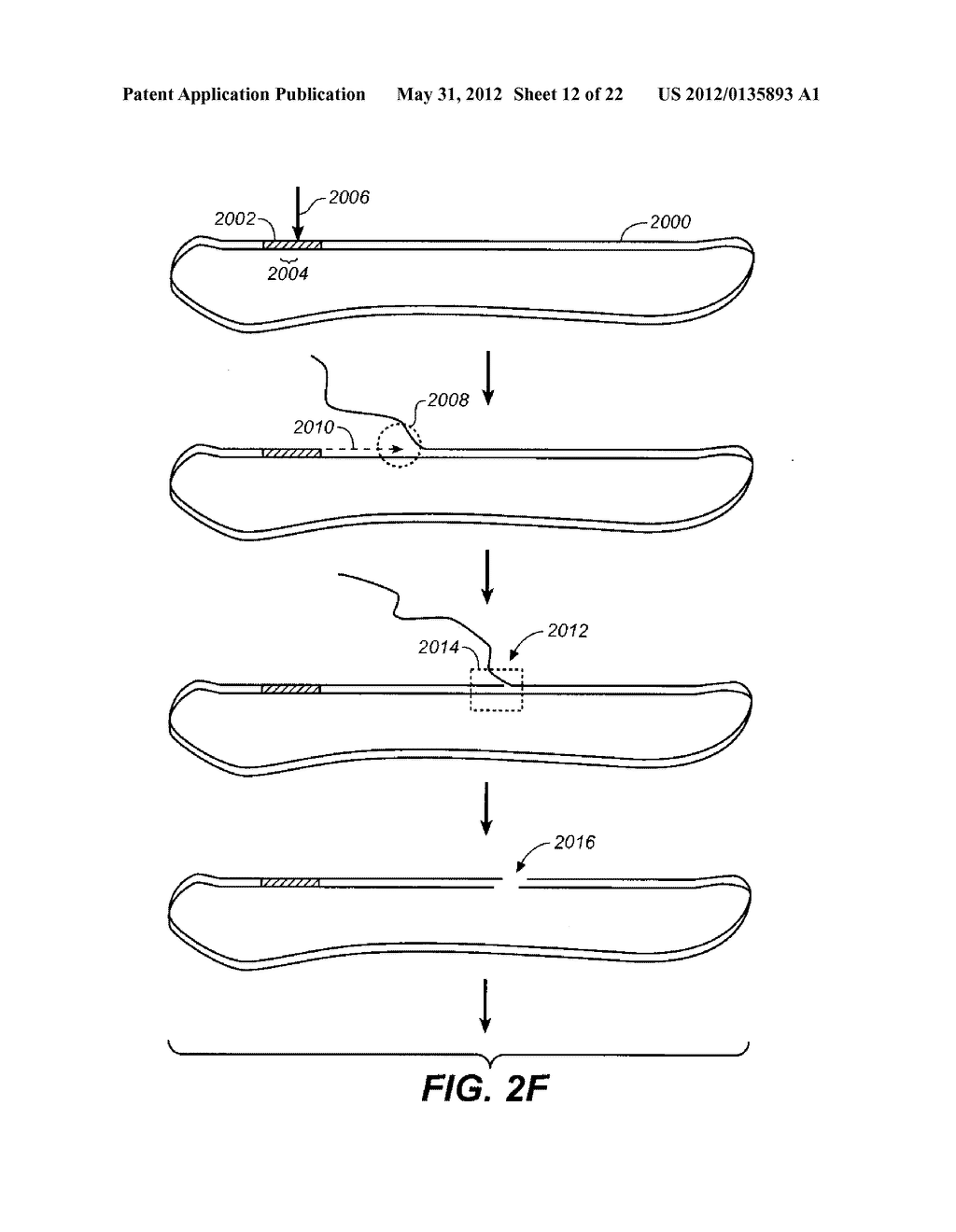 High throughput genome sequencing on DNA arrays - diagram, schematic, and image 13