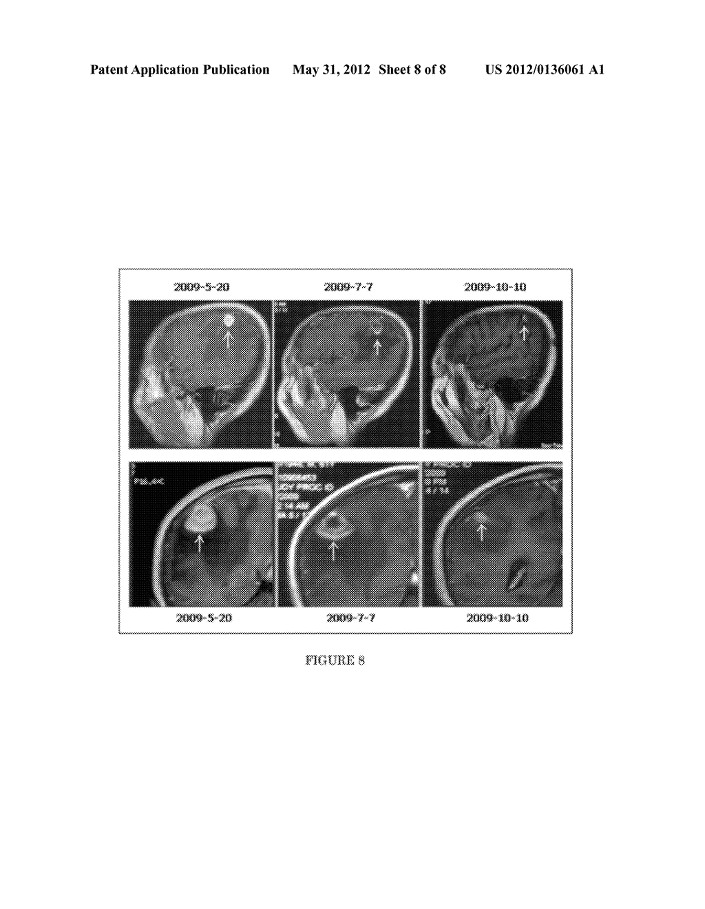 LYCOPENE AND RESVERATROL COMPOSITIONS FOR NK CELL ACTIVATION RESULTING IN     ANTI-NEOPLASTIC EFFECT - diagram, schematic, and image 09