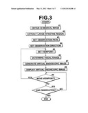 MEDICAL IMAGE PROCESSING APPARATUS METHOD AND PROGRAM diagram and image