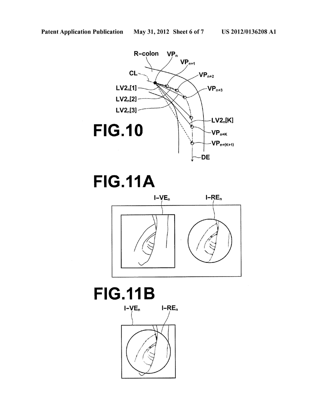 MEDICAL IMAGE PROCESSING APPARATUS METHOD AND PROGRAM - diagram, schematic, and image 07