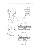 METHOD FOR SPECTROPHOTOMETRIC BLOOD OXYGENATION MONITORING OF THE LOWER     GASTROINTESTINAL TRACT diagram and image