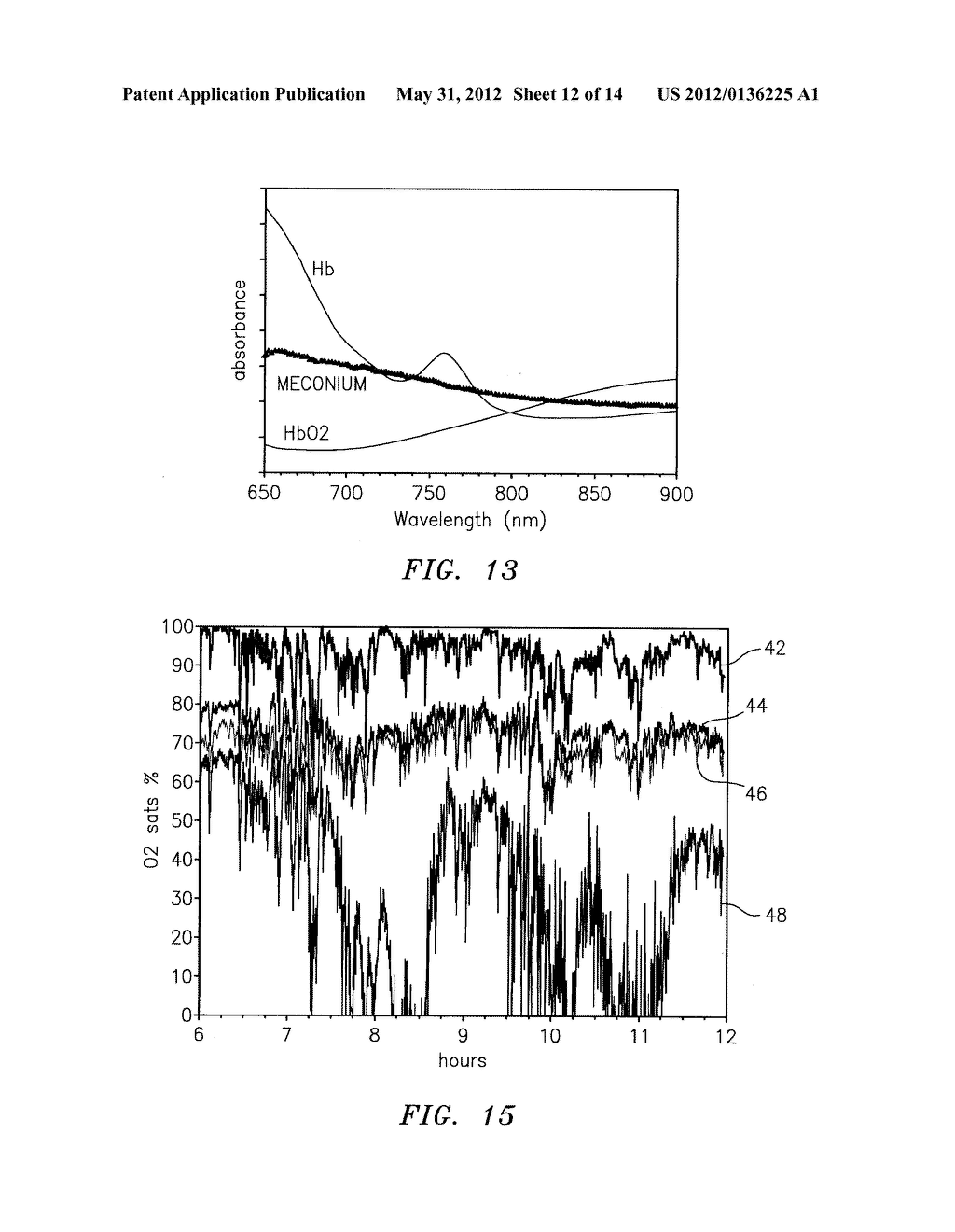 METHOD FOR SPECTROPHOTOMETRIC BLOOD OXYGENATION MONITORING OF THE LOWER     GASTROINTESTINAL TRACT - diagram, schematic, and image 13