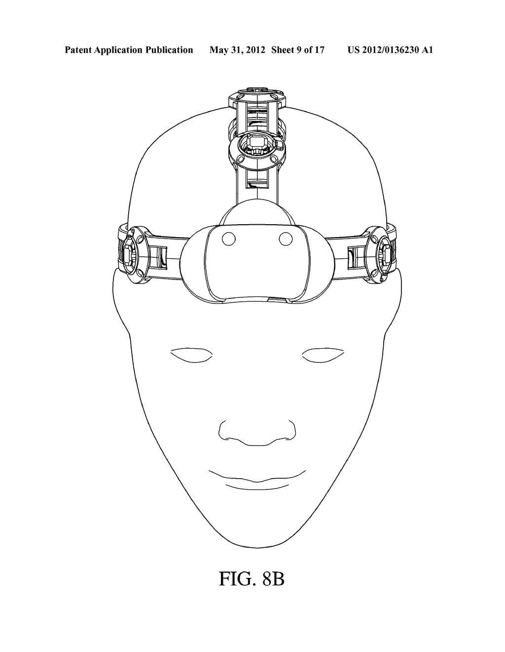 METHOD AND DEVICE FOR QUICK PRESS ON EEG ELECTRODE - diagram, schematic, and image 10