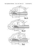 BIOPSY DEVICES AND METHODS diagram and image