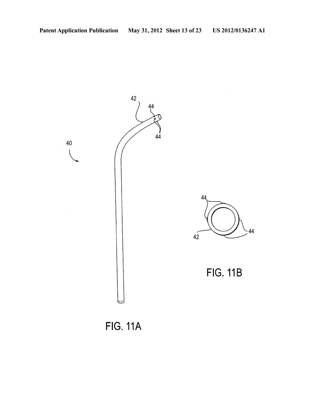 Methods of Transvascular Retrograde Access Placement and Devices for     Facilitating the Placement - diagram, schematic, and image 14