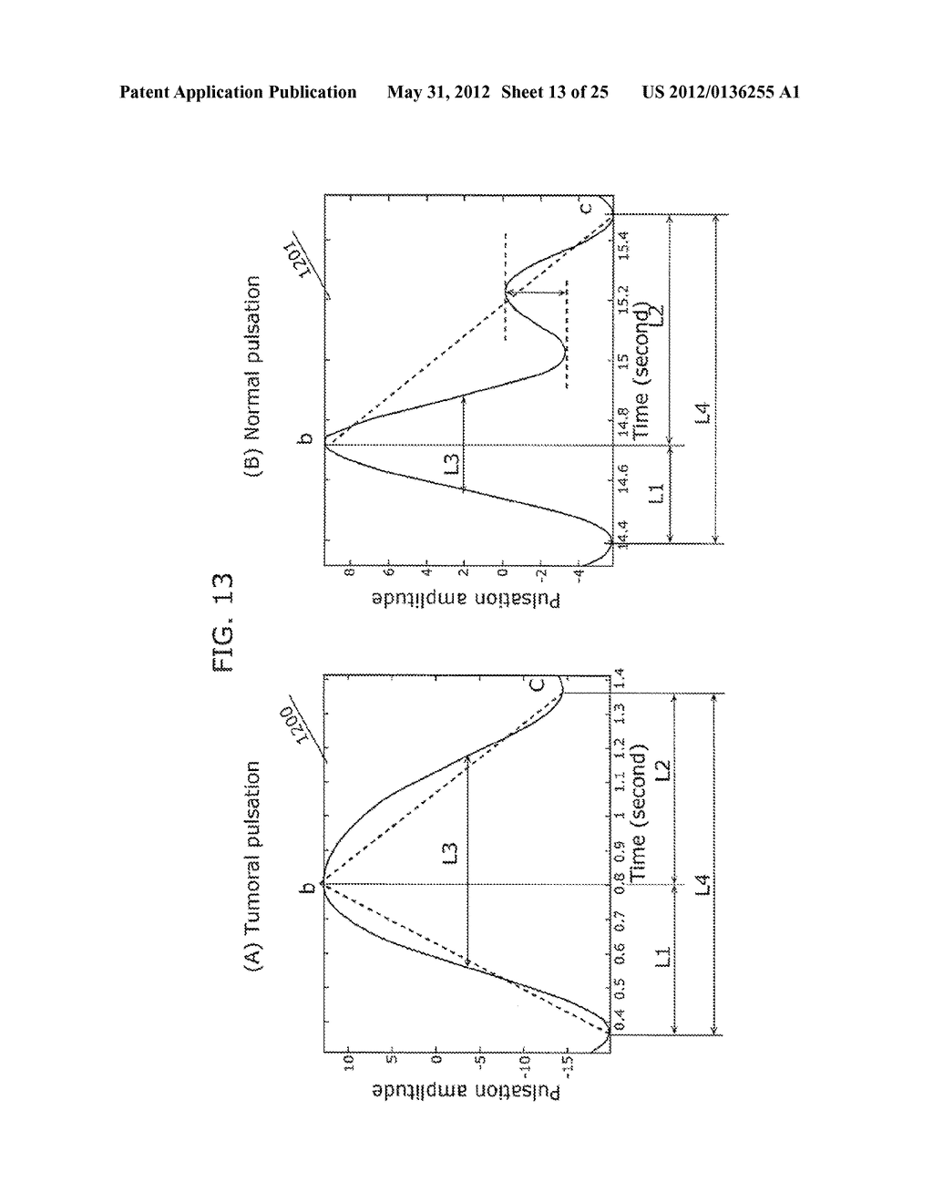 TISSUE MALIGNANT TUMOR DETECTION METHOD AND TISSUE MALIGNANT TUMOR     DETECTION APPARATUS - diagram, schematic, and image 14