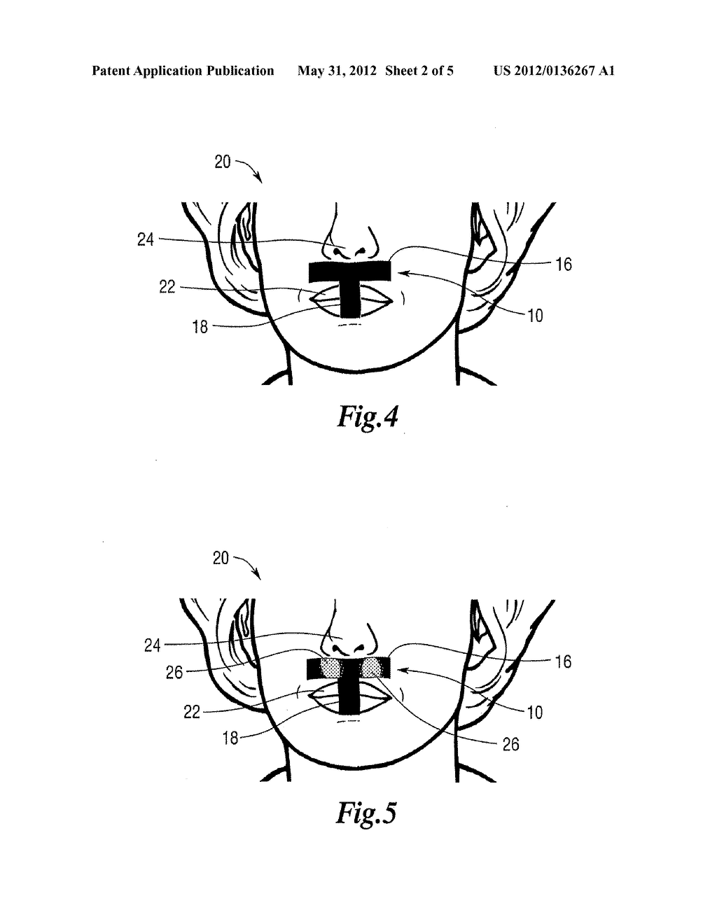 Apparatus and Method For Visually Determining Whether Respiration is     Occurring - diagram, schematic, and image 03