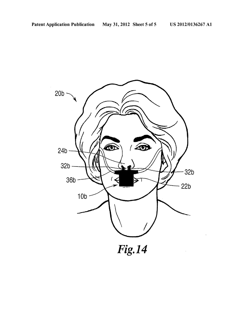 Apparatus and Method For Visually Determining Whether Respiration is     Occurring - diagram, schematic, and image 06