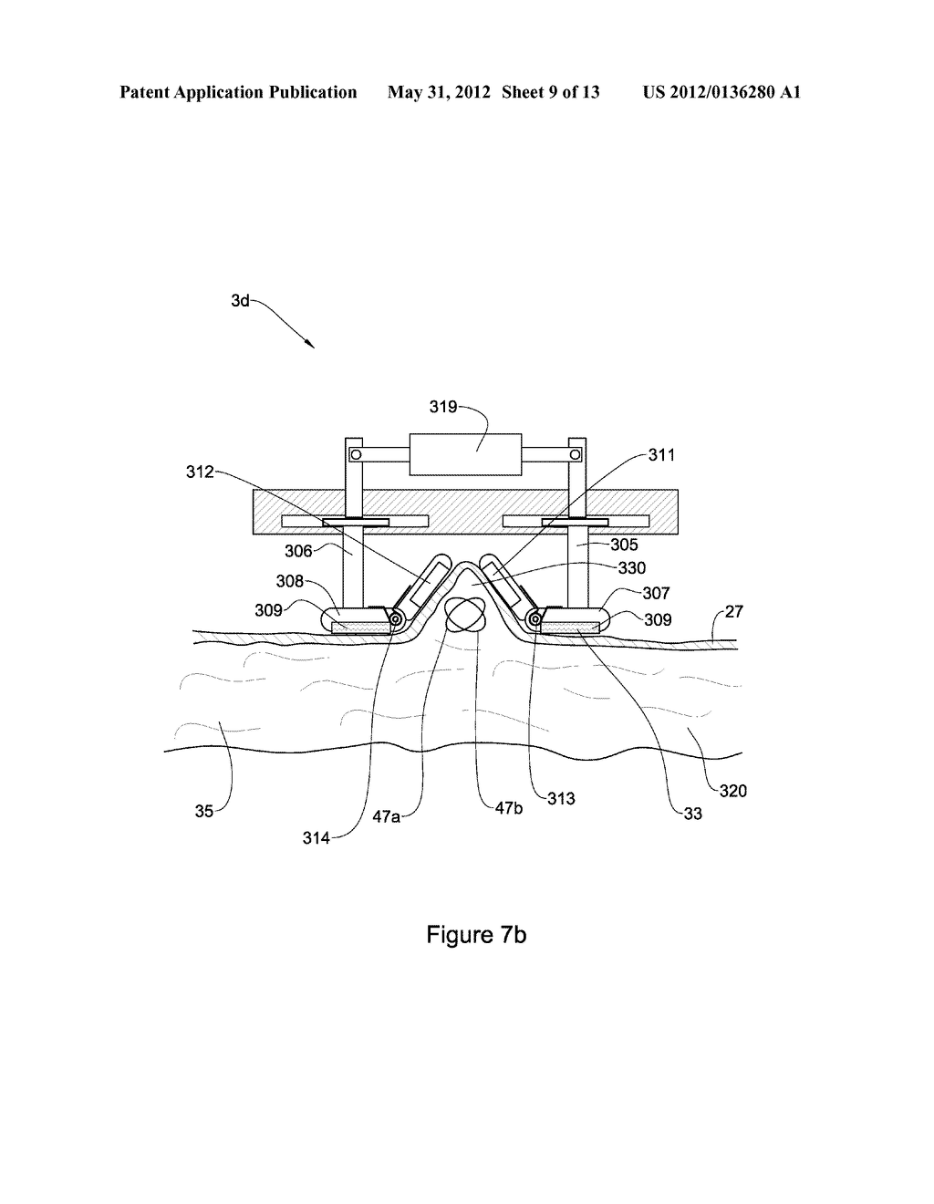 METHOD AND APPARATUS FOR TREATMENT OF ADIPOSE TISSUE - diagram, schematic, and image 10