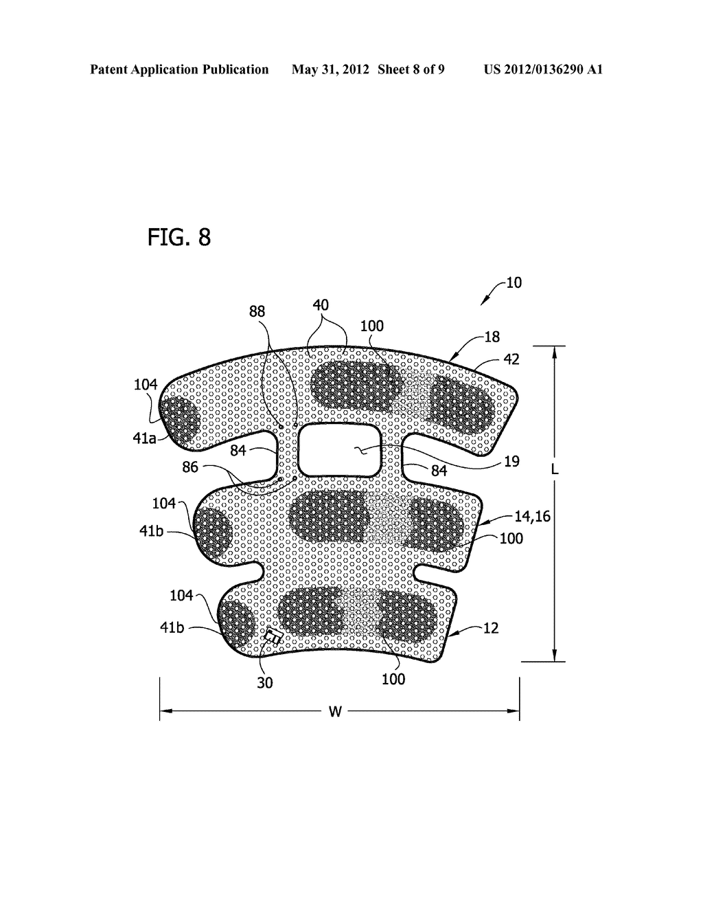 COMPRESSION DEVICE WITH WEAR AREA - diagram, schematic, and image 09