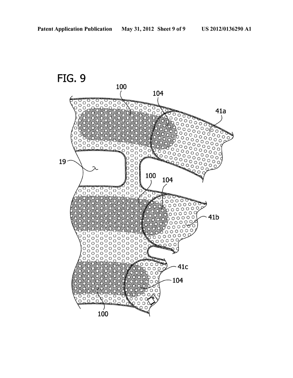 COMPRESSION DEVICE WITH WEAR AREA - diagram, schematic, and image 10