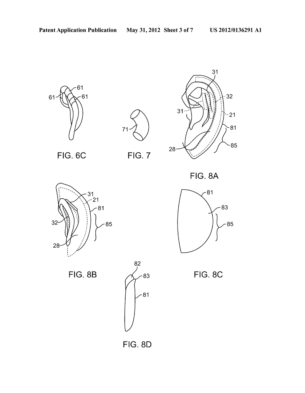 Correcting Misshaped Ears - diagram, schematic, and image 04