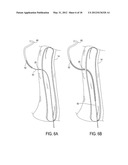 Methods of Transvascular Retrograde Access Placement and Devices for     Facilitating the Placement diagram and image