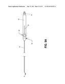 Methods of Transvascular Retrograde Access Placement and Devices for     Facilitating the Placement diagram and image