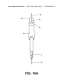 Methods of Transvascular Retrograde Access Placement and Devices for     Facilitating the Placement diagram and image