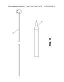 Methods of Transvascular Retrograde Access Placement and Devices for     Facilitating the Placement diagram and image