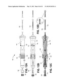 Methods of Transvascular Retrograde Access Placement and Devices for     Facilitating the Placement diagram and image