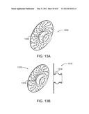 OSTOMY CONTAINMENT DEVICE diagram and image