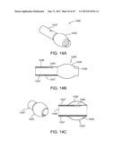 OSTOMY CONTAINMENT DEVICE diagram and image