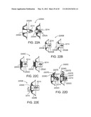 OSTOMY CONTAINMENT DEVICE diagram and image