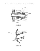 OSTOMY CONTAINMENT DEVICE diagram and image