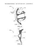 OSTOMY CONTAINMENT DEVICE diagram and image