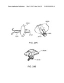 OSTOMY CONTAINMENT DEVICE diagram and image