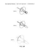 OSTOMY CONTAINMENT DEVICE diagram and image