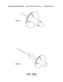 OSTOMY CONTAINMENT DEVICE diagram and image