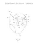 Refastenable Absorbent Article and a Method of Applying Thereof diagram and image