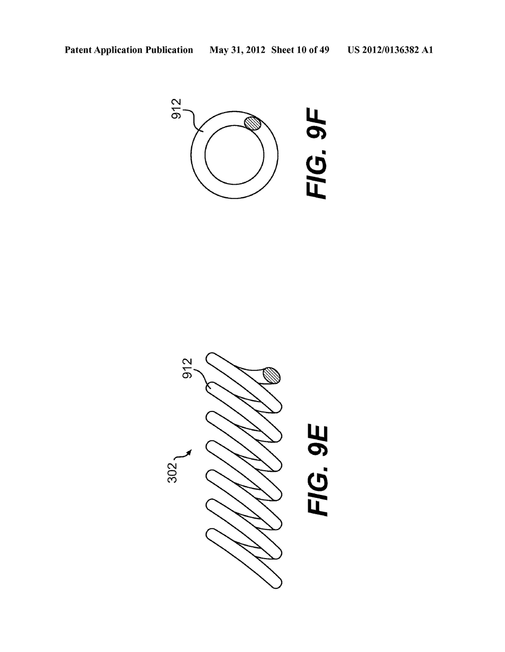 ENDOVASCULAR DEVICES AND METHODS FOR EXPLOITING INTRAMURAL SPACE - diagram, schematic, and image 11