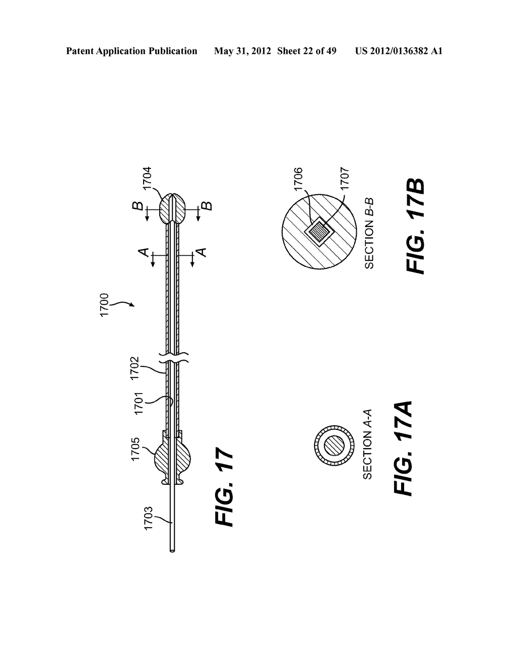 ENDOVASCULAR DEVICES AND METHODS FOR EXPLOITING INTRAMURAL SPACE - diagram, schematic, and image 23