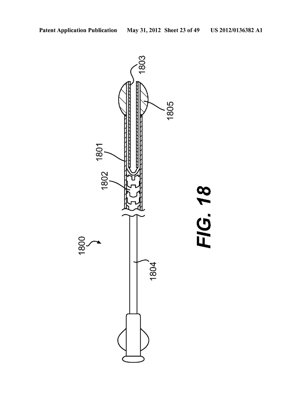 ENDOVASCULAR DEVICES AND METHODS FOR EXPLOITING INTRAMURAL SPACE - diagram, schematic, and image 24