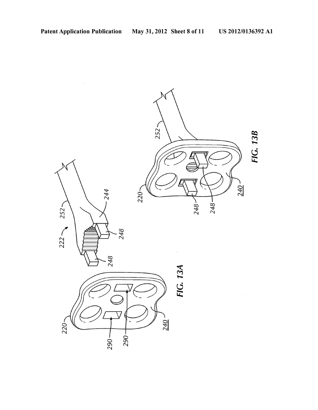 System and Method for Stabilizing Vertebrae in Spine Surgery Through a     Lateral Access Channel - diagram, schematic, and image 09