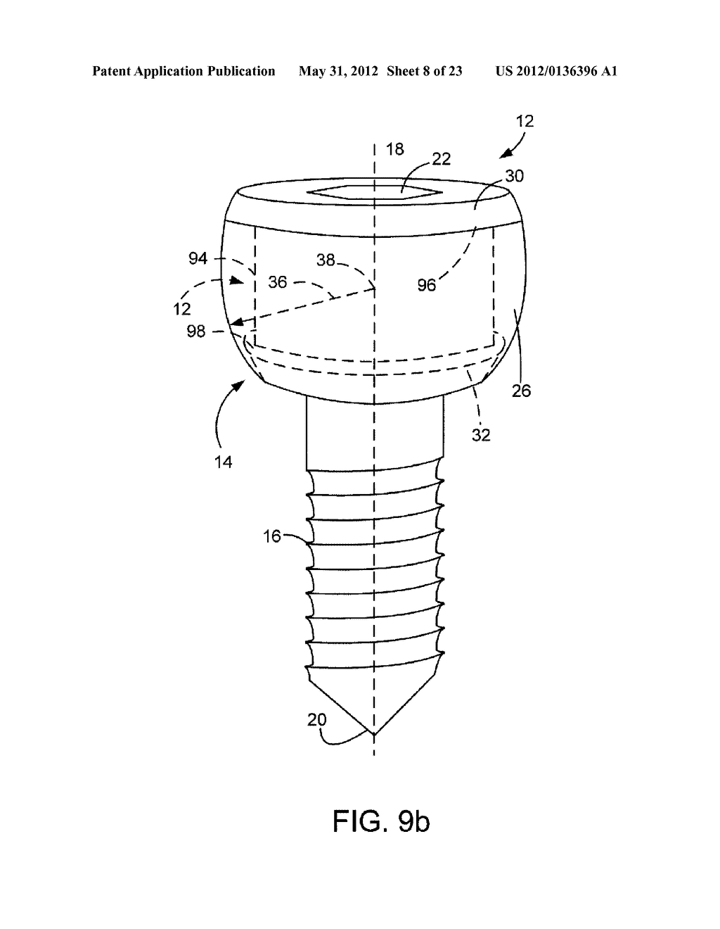 POLYAXIAL FASTENER SYSTEMS AND METHODS - diagram, schematic, and image 09