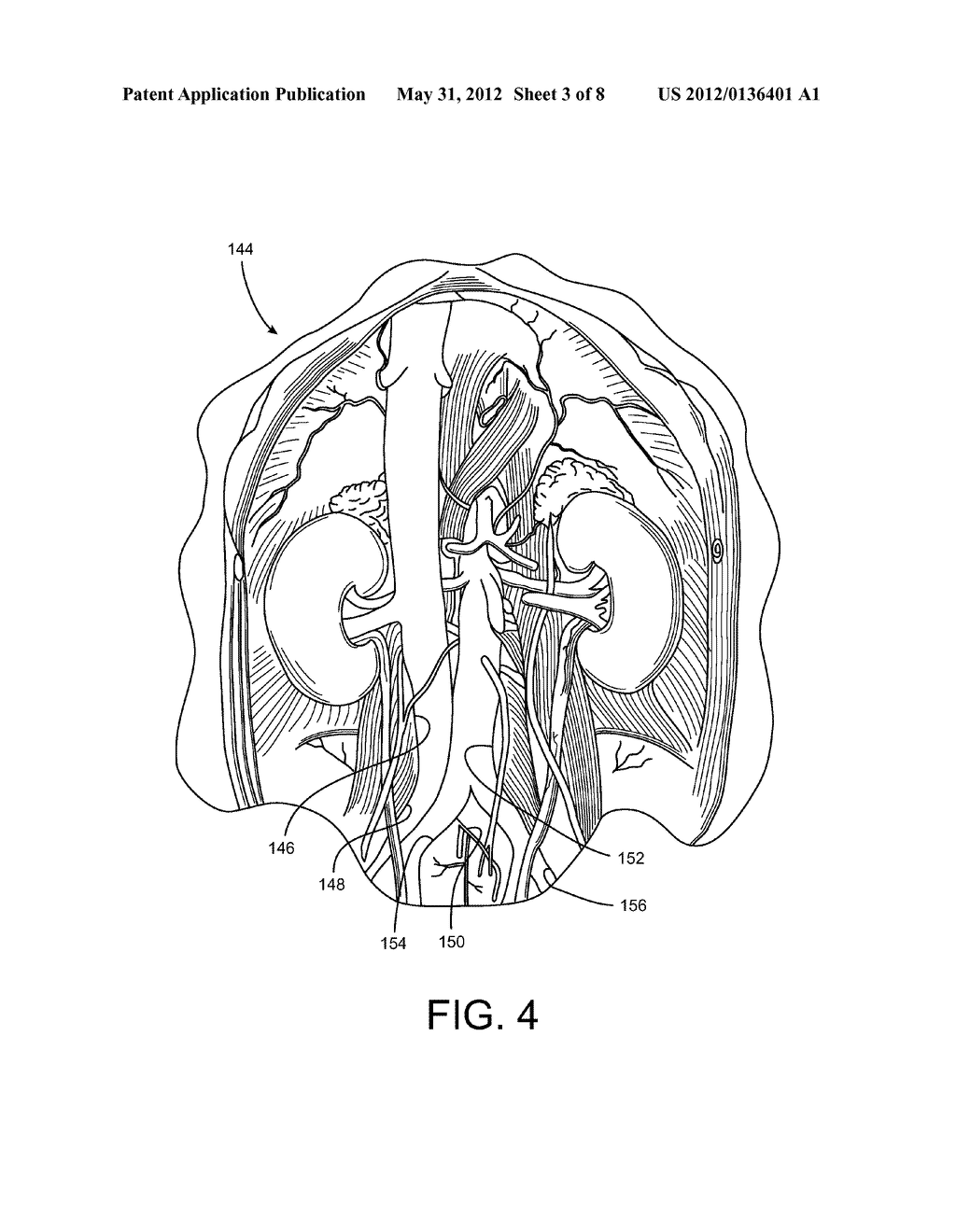 Medical Procedure Involving Protective Pad - diagram, schematic, and image 04