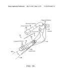 INCONTINENCE TREATMENT WITH URETHRAL GUIDE diagram and image