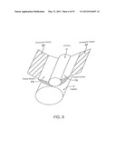 INCONTINENCE TREATMENT WITH URETHRAL GUIDE diagram and image