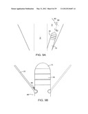 INCONTINENCE TREATMENT WITH URETHRAL GUIDE diagram and image