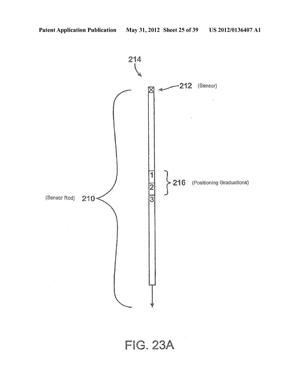 INCONTINENCE TREATMENT WITH URETHRAL GUIDE - diagram, schematic, and image 26