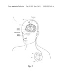 WAVEFORM SHAPES FOR TREATING NEUROLOGICAL DISORDERS OPTIMIZED FOR ENERGY     EFFICIENCY diagram and image